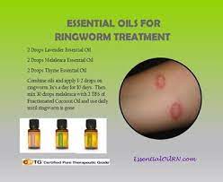 This is definitely important so that things go back to normal sooner rather than later. Can Hand Sanitizer Kill Ringworm