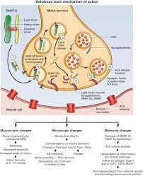 Complications and adverse reactions with the use of botulinum toxin. Figure 4 Botulinum Toxin In The Management Of Children With Cerebral Palsy Springerlink