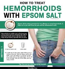 How To Use Epsom Salt To Relieve Hemorrhoids Home Remedies For Hemorrhoids Hemorrhoids Treatment Getting Rid Of Hemorrhoids