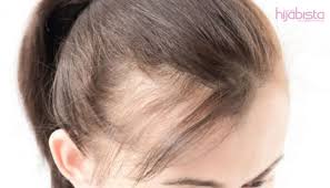 Lepas akak bersalinkan anak sulung dulu, rambut akak kerap gugur dan sekarang anak akak dah 5 orang. Ini Puncanya Rambut Gugur Di Usia Remaja Rawatlah Rambut Anda Sebelum Menjadi Botak Hijabista