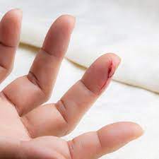 Memproteksi diri agar tidak kedinginan. Apa Tanda Jari Berdarah Terkena Pisau Apa Maksudnya