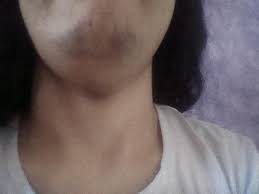 Check spelling or type a new query. Dark Skin After Waxing In Chin What To Do Photo