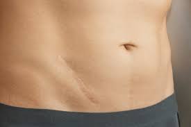 Being underweight can lead to frequent illness, fatigue, hair loss, anemia, and osteoporosis.1. Appendicitis Facts Causes Symptoms Complications Treatment Factdr