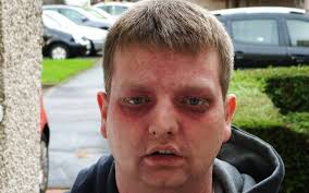 Daniel's Brain Tumour Diagnosis