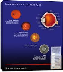 Pin On Optometric Resources