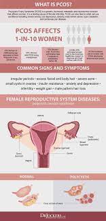Polycystic ovary syndrome (pcos) test. Pcos Symptoms Causes And Support Strategies Drjockers Com