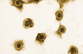 In the lab where you got it done, <1, is normal for igm, and <20 for igg. Flawed Herpes Testing Leads To False Positives Needless Suffering Stat