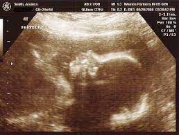 Find out how many days, months, and/or years until you turn a specific age. Almost 28 Weeks Only 8 Days Till My Birthday Long Time Since Last Post Sometimes I Wonder