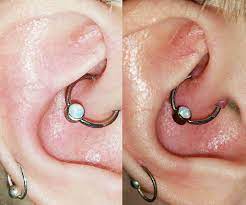 Piercing Bump 6 Ways To Get Rid Of Cartilage Or Nose Keloid Blister