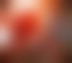 Image result for Colonoscopy in GI Bleeding