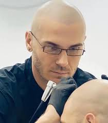 SMP Scalp Micropigmentation Liverpool