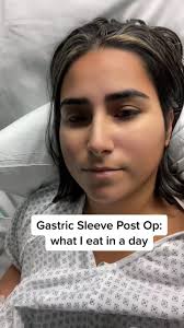 Day 3 post op. #bariatricsurgery #gastricsleeve #sleevegastrectomy  #liquiddiet #weightlossjourney #iih #pcos