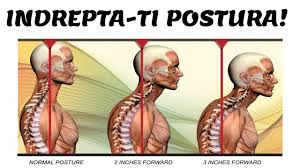 Persoanele de vârstă mijlocie aleg o saltea ortopedică la discreția lor. ExistÄƒ O TendinÈ›Äƒ Medicinal CÄƒsÄƒtorit Aparat Pentru Indreptat Coloana Tipomur Ro
