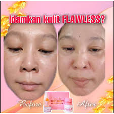 Memiliki kulit putih, mulus, bersih, sehat dan kencang adalah idaman bagi siapa saja. Colly Et Produk Putihkan Kulit Berkesan Selamat Murah Shopee Malaysia