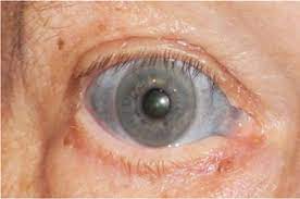 Remember, your lashes have a life cycle: Women Are Suing Rodan Fields Over Side Effects From One Of Its Most Popular Products