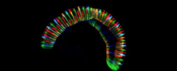 Image result for Neisseriaceae