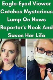 Eagle Eyed Viewer Catches Mysterious Lump On News Reporter S Neck And Saves Her Life In 2021 Save Her Real Life Stories Mystery