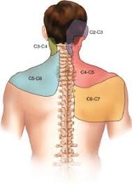 Pin On Auto Accident Injuries Chiropractor In Framingham Ma