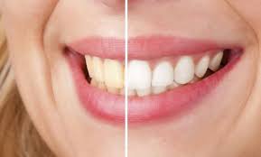 Maybe you would like to learn more about one of these? Alimentos Que Ponen Tus Dientes Amarillos