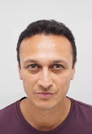 Emmerdale's Chris Bisson reveals he's had a hair transplant to retain his  good looks and protect his career