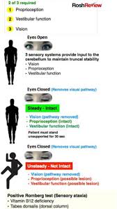 Image result for Cerebellar Function Test