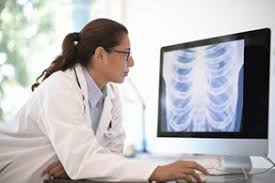 In fact, lung cancer (along with colorectal, breast and prostate cancers) is one of the four types that make up close to 50% of all cancer cases diagnosed in canada. Critical Canadian Lung Cancer Projections Canadian Cancer Society