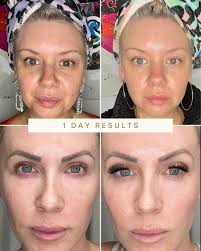 How often should you exfoliate for healthy skin?