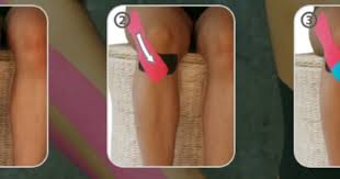 Pin On Kinesiology Taping
