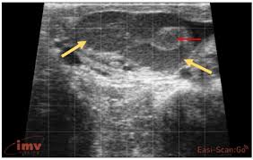 Image result for corpus luteum sonography)