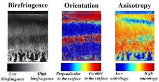 Image result for Polarized Microscopy