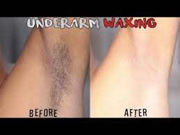 Hello all :) here i share how i wax my underarms at home. Underarm Hair Removal At Home Underarm Waxing Youtube