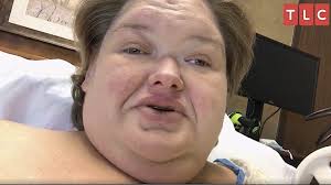 Amy Slaton's Eye Condition & Blindness Explained