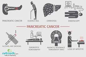 In general, here are some of the symptoms that commonly lead to the diagnosis of pancreatic cancer. Pancreatic Cancer Causes Symptoms And Treatment Netmeds
