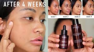 Community collections with avoskin miraculous refining serum. 4 Week Challenge Using Avoskin Miraculous Refining Series Youtube