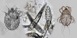The types of symbiosis are termed commensalism, mutualism, and parasitism. Ungex Demodex Mite On Human Skin The Comprehensive Guide