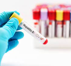 Hepatita B Simptomele La Care Sa Fii Atent Tratament Vaccin Hepatita B