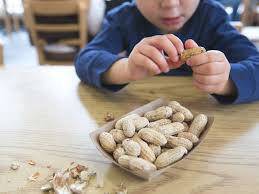 Approximately 50 million americans are affected by some form of allergy. Kids And Food Allergies What To Look For