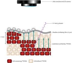 There can be other areas but this is good news. Intraoperative 18 F Fdg Flexible Autoradiography For Tumour Margin Assessment In Breast Conserving Surgery A First In Human Multicentre Feasibility Study Ejnmmi Research Full Text