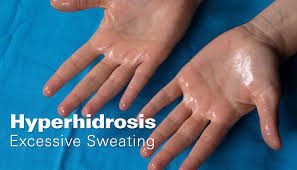 Image result for Hyperhidrosis Causes