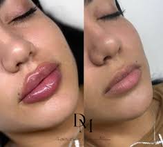 Aesthetic Beauty by Daria Morris (@aestheticbeautybydariamorris) •  Instagram photos and videos