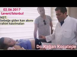 Nst neden ve nasıl yapılır? Nts Nedir Download Music Mp3 And Mp4 Katenyc