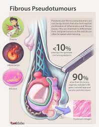 Image result for Pseudoeriosema