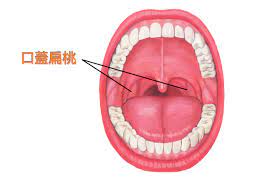 扁桃 腺 が ボコボコ