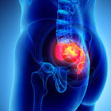 Lower Back Pain Esp Physio Scotland