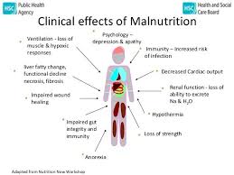 Pin On Dietetics