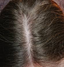 I've been bleaching my hair (platinum) for the past 6 months or so and i'm really feeling the damage lately :( wanting to grow out my roots to blend it into a balayage so looking for something that might help my hair grow faster? Review Will The Ordinary S Multi Peptide Serum Increase Hair Density An Introvert Talks