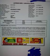 Cek Fakta Foto Hasil Tes Swab Rizieq Shihab Positif Covid 19 Ini Faktanya