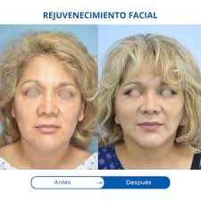 Dr. Otto Enrique Ziegler Gutierrez Cirujano plástico, Lima