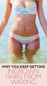 Why You Keep Getting Ingrown Hairs From Waxing Ingrown Hair From Waxing Ingrown Hair Ingrown Hair Bikini