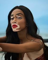 Winnie Harlow